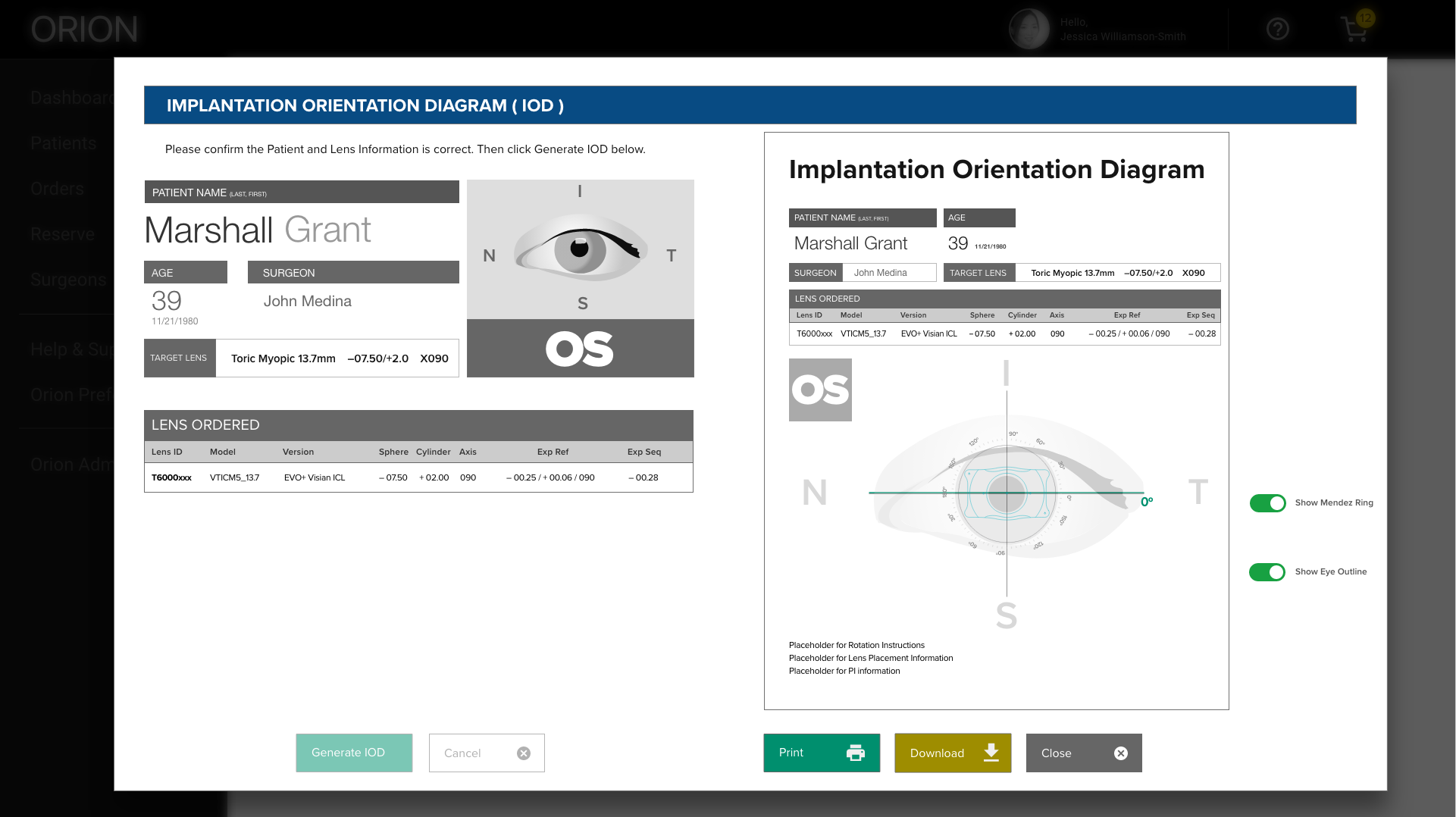IOD printout screen for ophthalmic inventory management