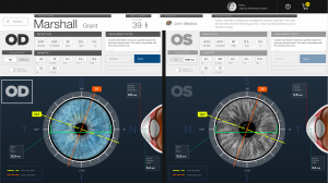 Screen capture of User Experience design for Ophthalmic Case Study