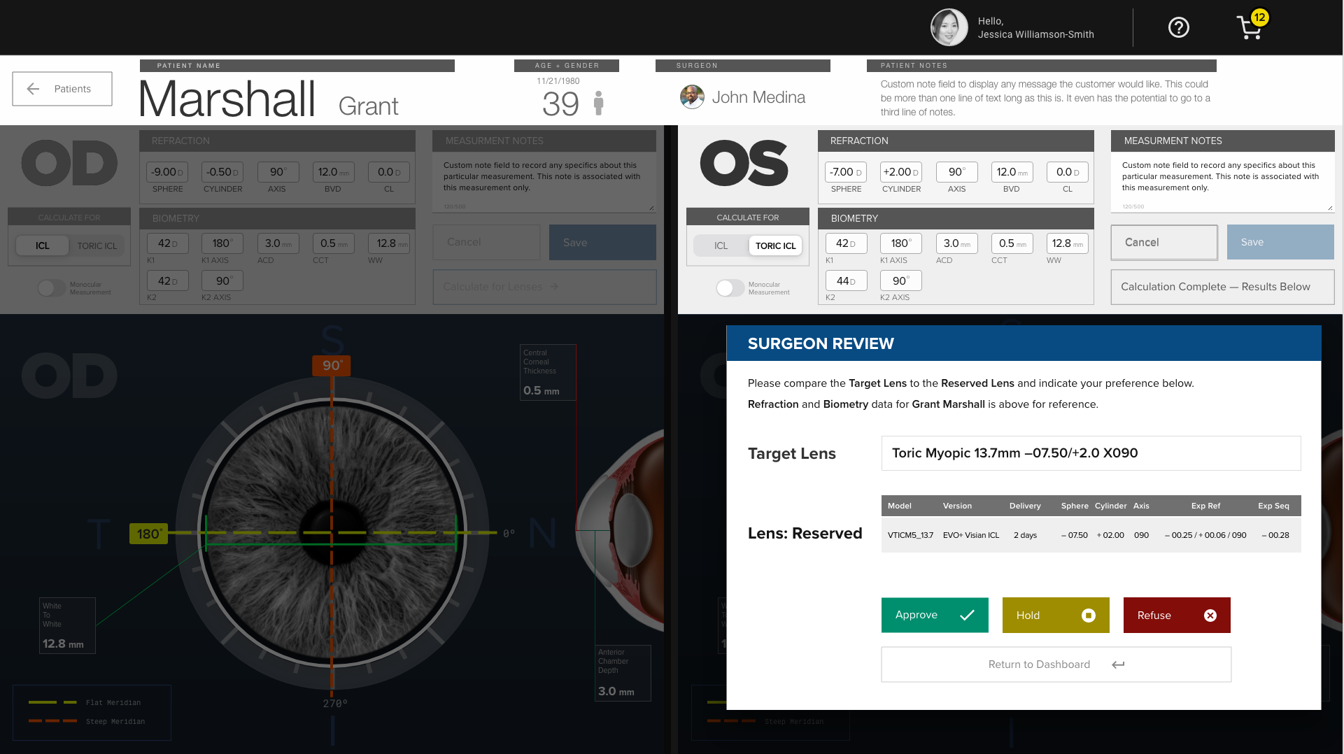 Surgeon review interface for ophthalmic inventory management